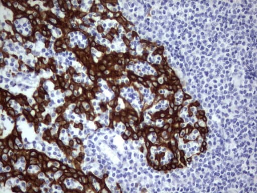Acidic Cytokeratin Antibody (clone 3E10)
