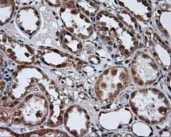 TUBA8 / Tubulin Alpha 8 Antibody (clone OTI3E10)