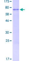 Human SDC1 / Syndecan 1 / CD138 Protein (Recombinant GST)