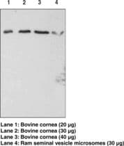 FP / PTGFR Antibody