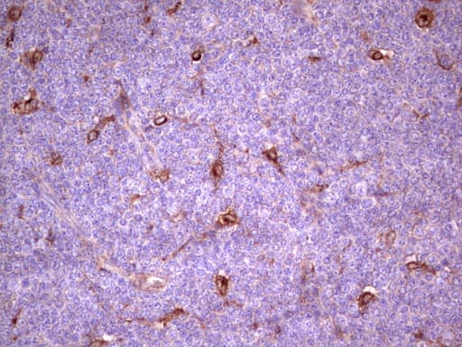 Monoclonal Mouse anti-Human APOE / Apolipoprotein E Antibody (clone OTI3D3, IHC, WB)