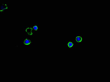 SLC2A2 / GLUT2 Antibody