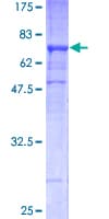 Human TUBB2A / Tubulin Beta 2A Protein (Recombinant GST)