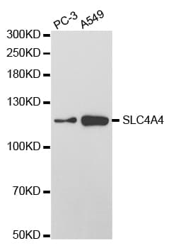 IHC-plus™ SLC4A4 / NBC1 Antibody