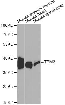 IHC-plus™ TPM3 Antibody