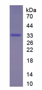 Human HSD17 / HSD17B1 Protein (Recombinant His-T7)