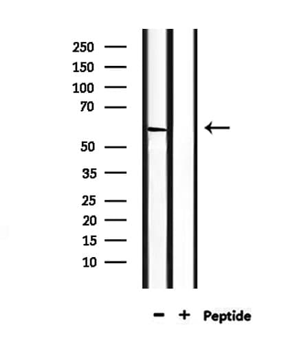 CDK17 / PCTK2 / PCTAIRE2 Antibody