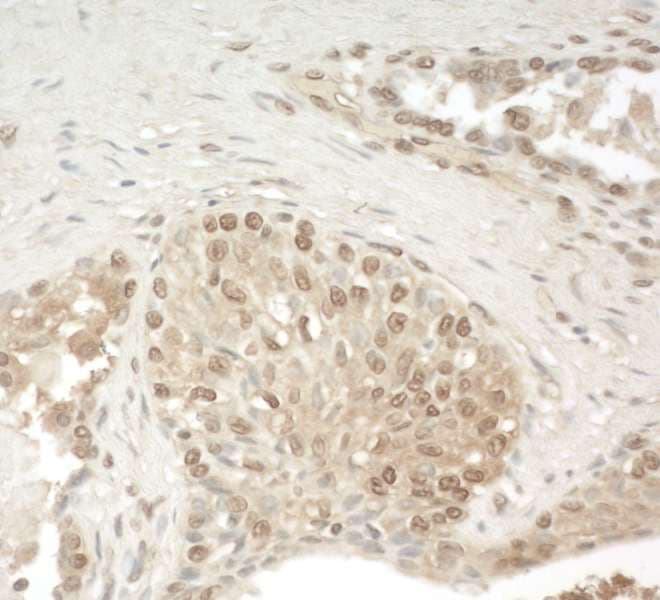 KIAA0191 / ZCCHC11 Antibody (aa250-300)