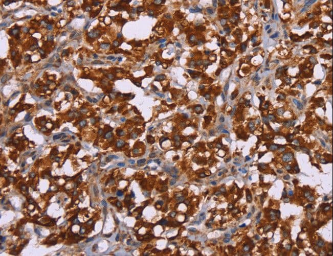 CYP2W1 Antibody