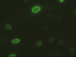 DFFA / ICAD / DFF45 Antibody (clone OTI1B10)