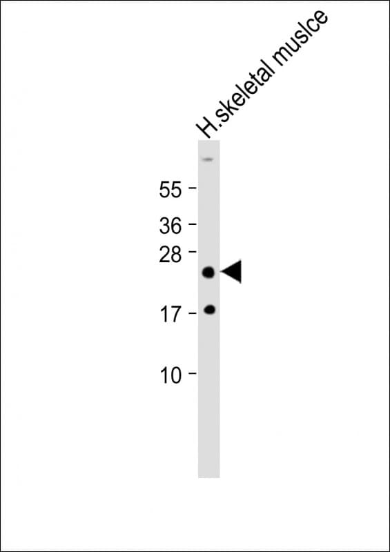HOXA7 Antibody (Internal)
