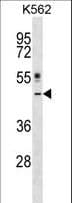 CRLF1 Antibody (aa255-283)