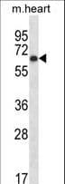 PKMYT1 Antibody (aa114-143)
