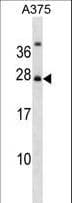 RPAIN Antibody (aa16-44)