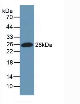 Human FN1 / Fibronectin Protein (Recombinant His, N-Terminal)