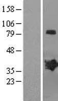 MAGEB2 Protein (Over-Expression Lysate Myc-DDK (Flag))