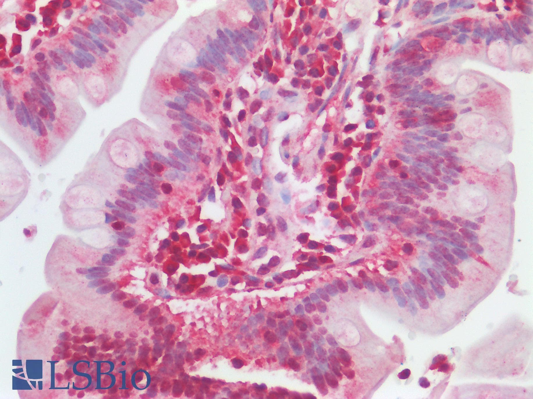 IHC-plus™ ABL1 / c-ABL Antibody (aa850-900)