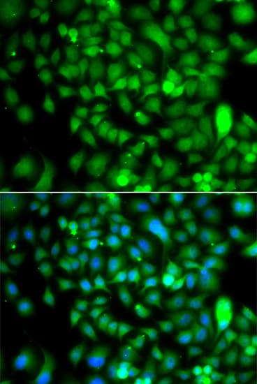 IHC-plus™ CSRP2BP Antibody