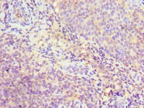 SRSF4 / SFRS4 Antibody (aa1-180)