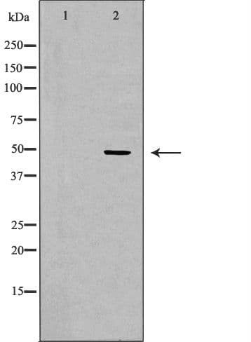 LTBR Antibody