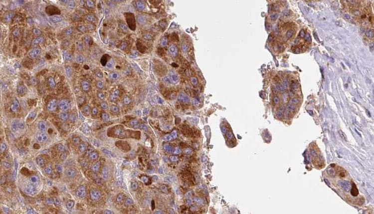 SLC16A1 / MCT1 Antibody