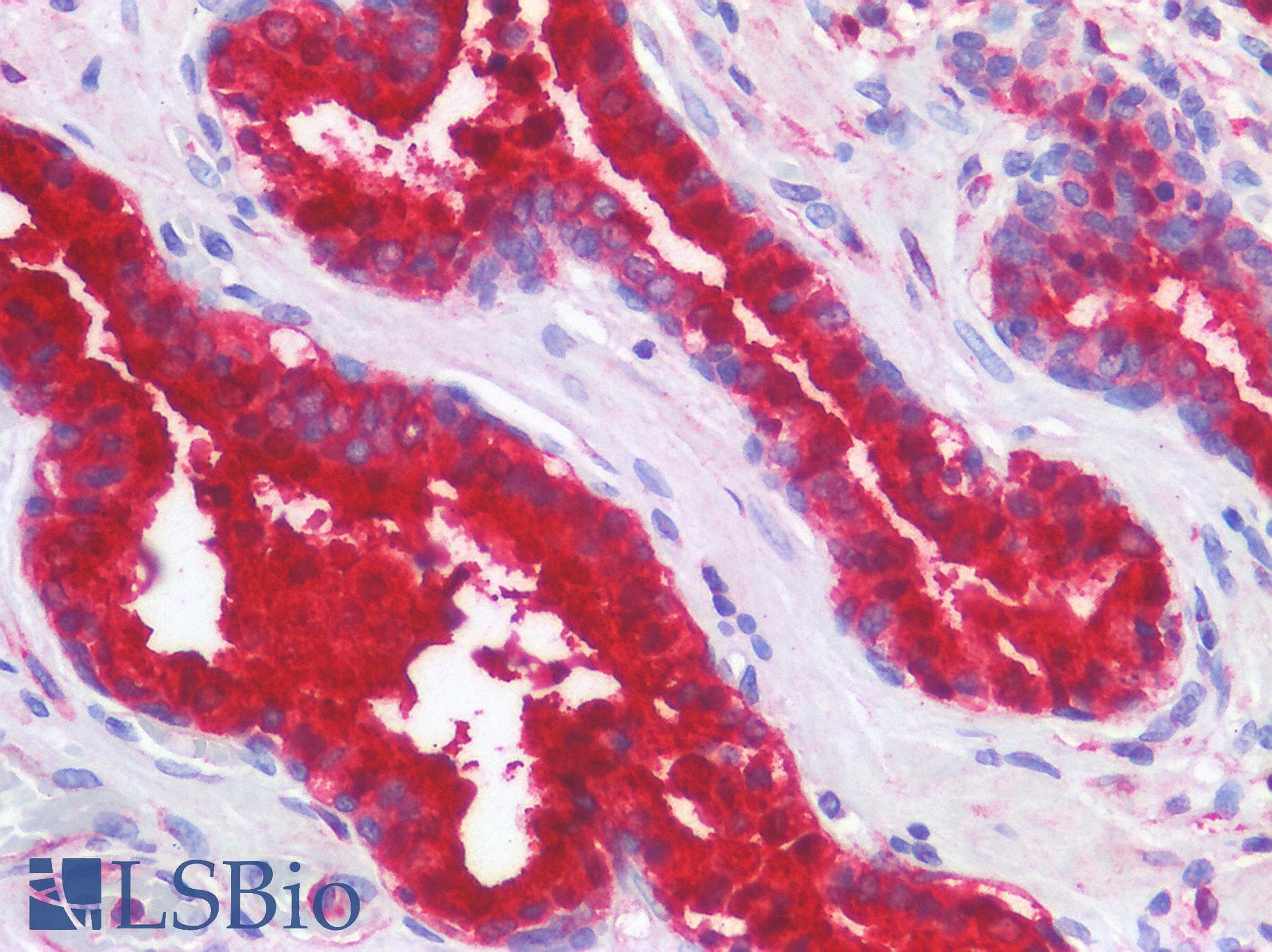 IHC-plus™ Polyclonal Rabbit anti-Human IL4 Antibody (IHC)
