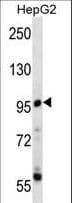 PPP1R3F Antibody (aa549-578)