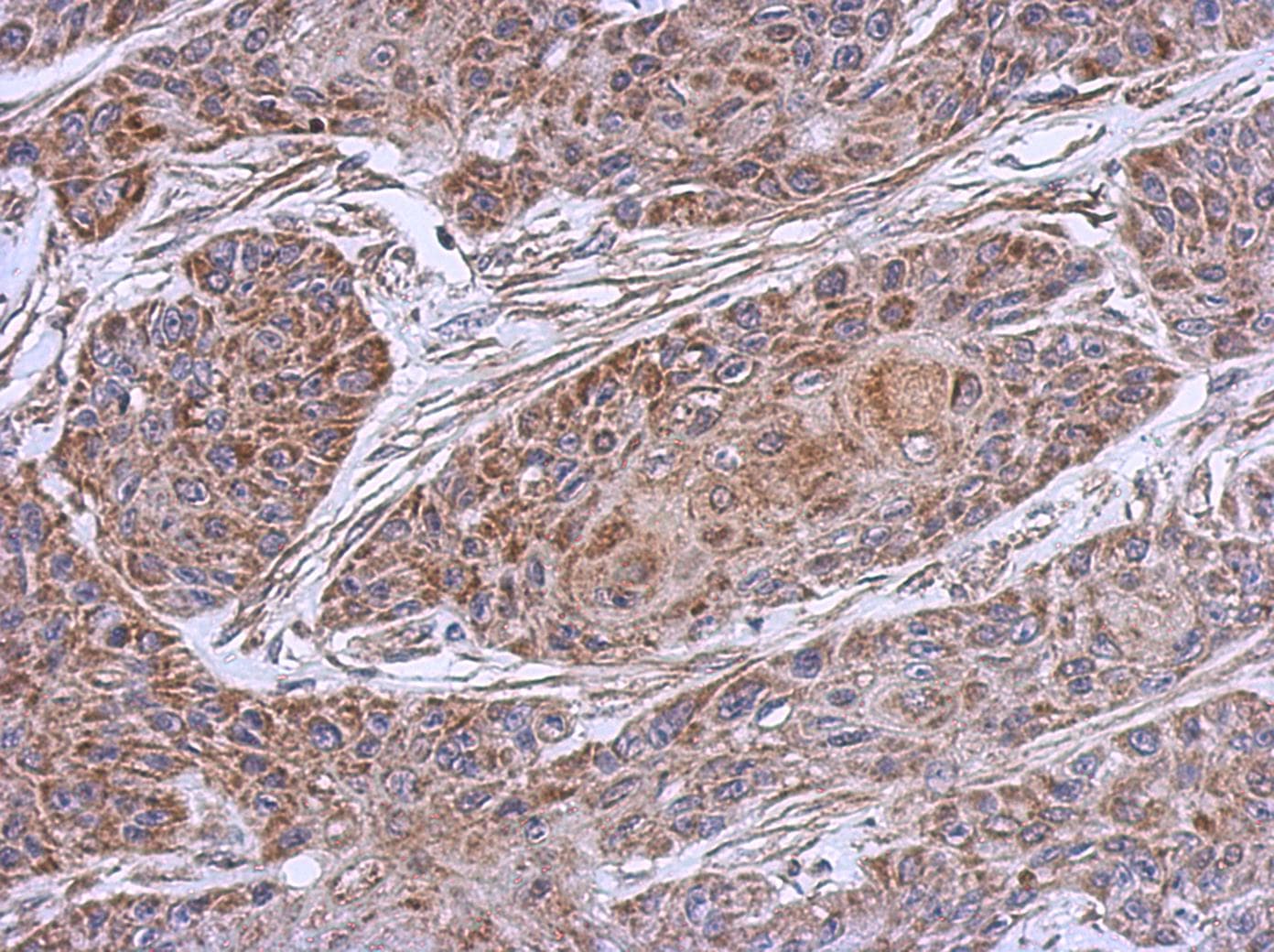 NDUFB4 / B15 Antibody