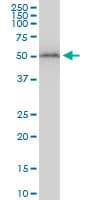 IHC-plus™ TUBB2A / Tubulin Beta 2A Antibody (clone 3B2)