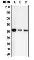 Polyclonal Rabbit anti-Human PAK2 Antibody (phospho-Ser20, WB)
