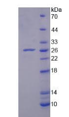 Chicken IL18 Protein (Recombinant His-T7, N-terminus)