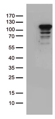 Monoclonal Mouse anti-Human MCF2 / DBL Antibody (clone OTI7F9, Carrier-free, aa872-1001, WB)