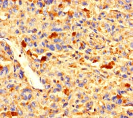 Polyclonal Rabbit anti-Human ZNF384 Antibody (IHC, WB)