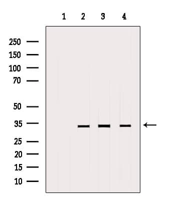 MTCH2 Antibody
