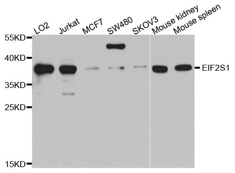 Polyclonal Rabbit anti-Human EIF2S1 Antibody (IHC, IF, WB)
