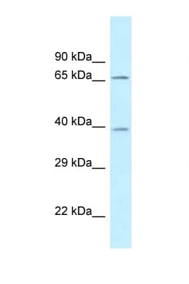 Polyclonal Rabbit anti-Human AGMAT Antibody (aa49-98, WB)