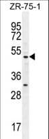 Polyclonal Rabbit anti-Human MEF2D Antibody (aa108-136, WB)