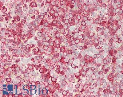 IHC-plus™ Monoclonal Mouse anti-Human Endonuclease G / ENDOG Antibody (clone 7F2D7, IHC, WB)