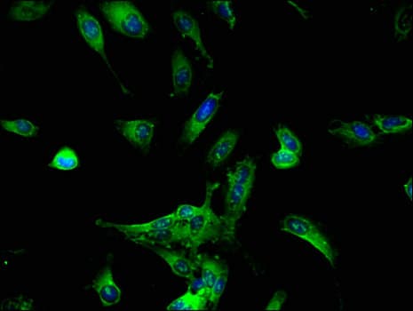 Polyclonal Rabbit anti-Human DDX6 Antibody (IHC, IF, WB)