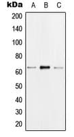 HNRNPK / hnRNP K Antibody (phospho-Ser284)