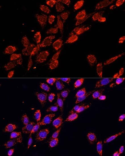 EIF4EBP1 / 4EBP1 Antibody