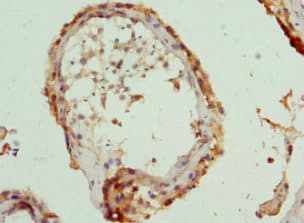 CCT5 / TCP1 Epsilon Antibody