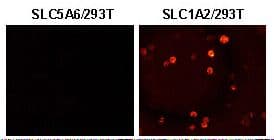 SLC1A2 / EAAT2 / GLT-1 Antibody (C-Terminus)