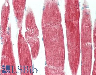 CDKN2C / p18 INK4c Antibody