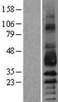 Human PDPN / Podoplanin Protein (Over-Expression Lysate Myc-DDK (Flag))