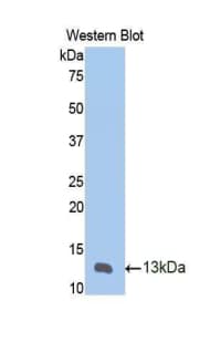 MMP12 Antibody (aa20-99, Cy3)