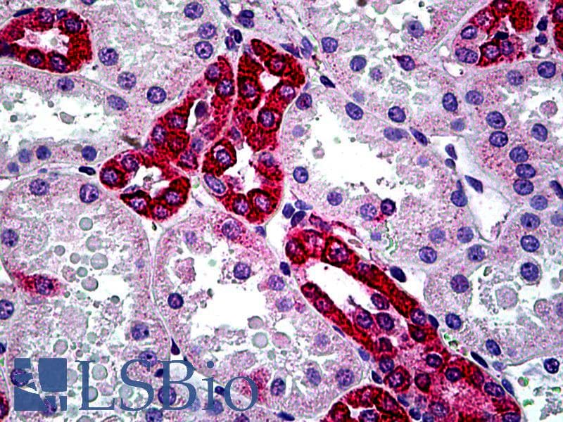 PathPlus™ CFTR Antibody (aa2-14)