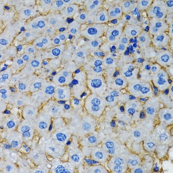 Polyclonal Rabbit anti-Human RAF1 / RAF Antibody (IHC, IF, WB)