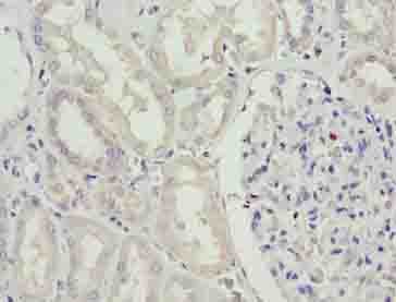 Polyclonal Rabbit anti-Human SDSL / Serine Dehydratase-Like Antibody (IHC, WB)