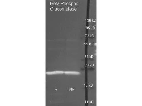 Beta-Phosphoglucomutase Antibody